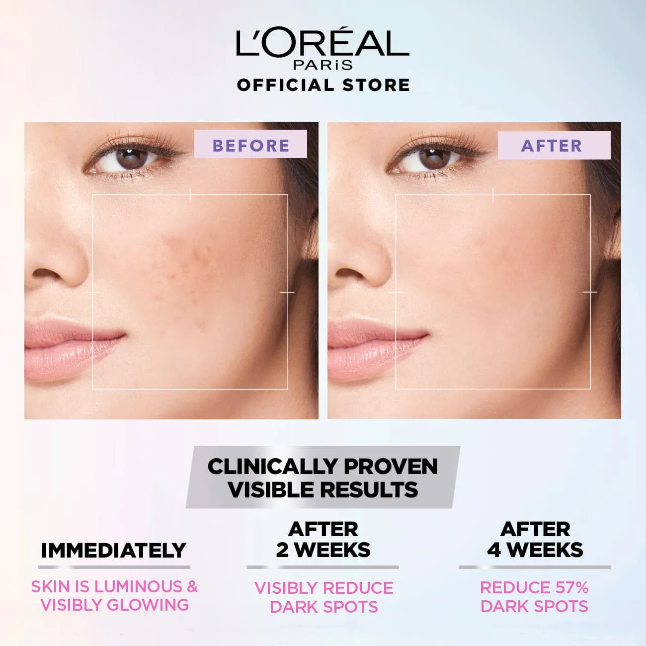 Loreal Paris Power Serum Duo - 30ml