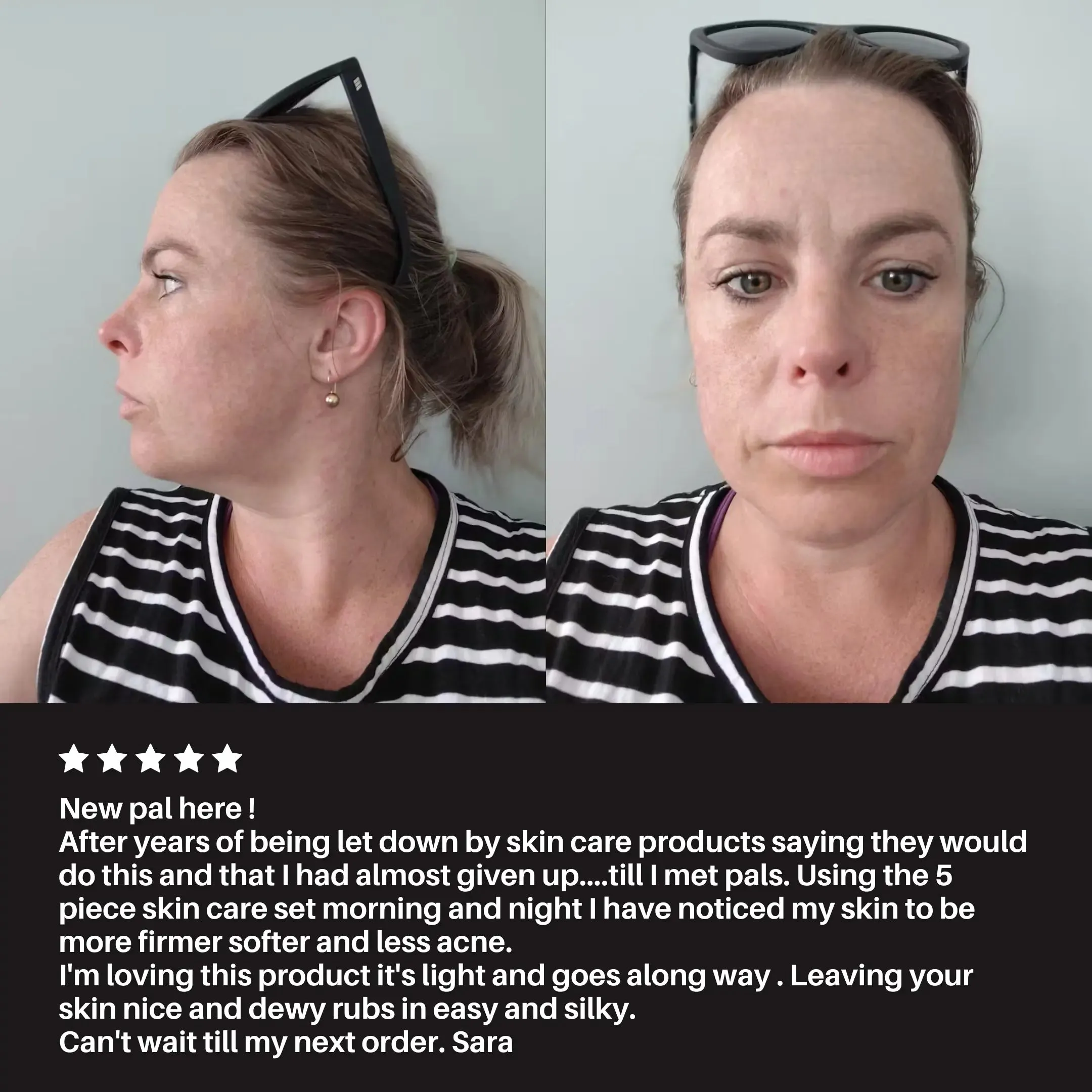 Transformation Kit