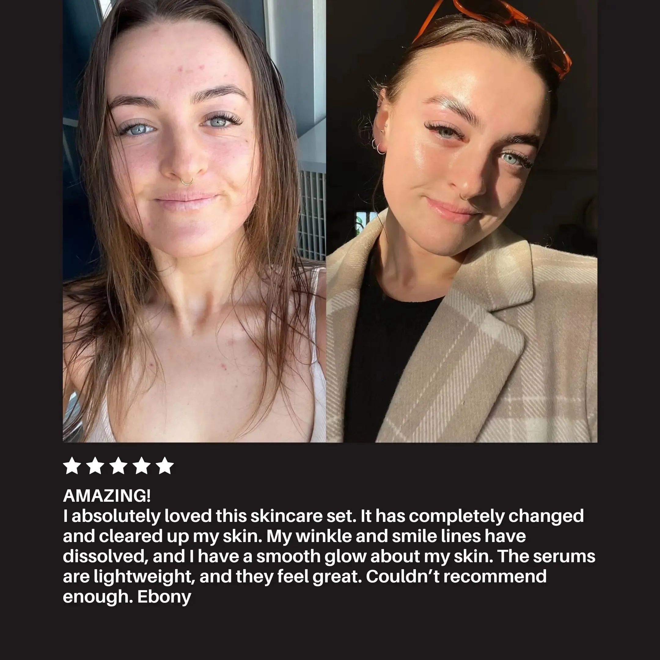 Transformation Kit